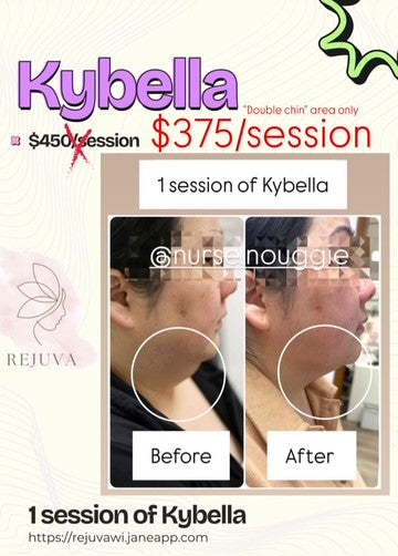 Kybella - "Double Chin" area only